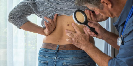 Dépistage du mélanome : les kinés d'Occitanie en renfort !